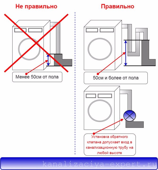 Filtres pour machines à laver à l'échelle: quels avis vaut-il mieux choisir