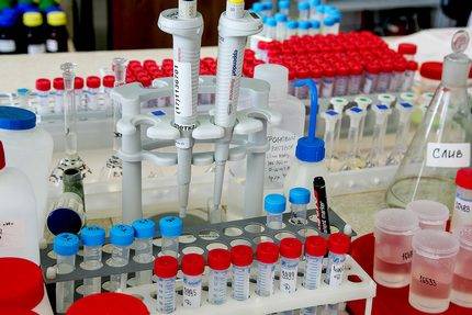 Quand et comment est l'analyse de l'eau du puits