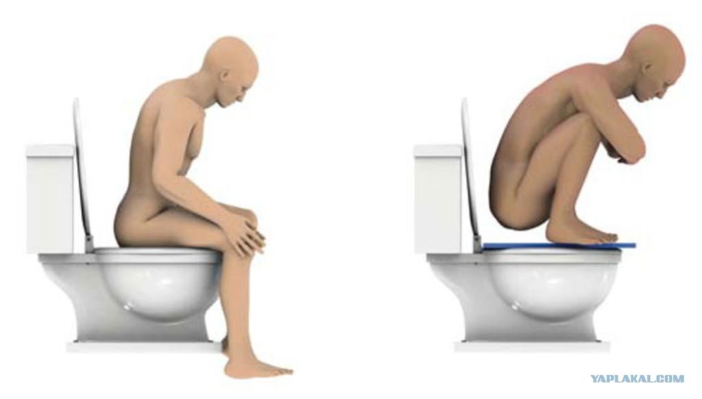 Les hommes peuvent-ils rester assis longtemps sur les toilettes ? Pourquoi les hommes ne peuvent-ils pas s'asseoir longtemps sur les toilettes ? quel est le danger de rester assis longtemps sur les toilettes