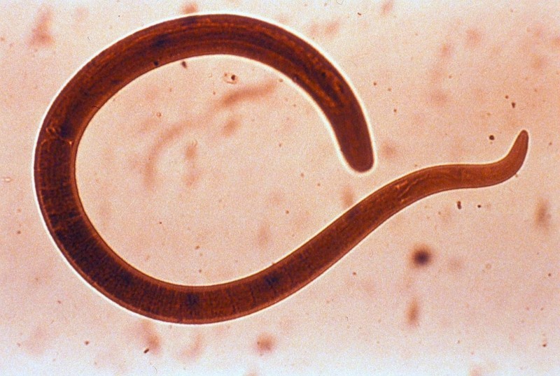 9 signes subtils que les parasites vivent en vous