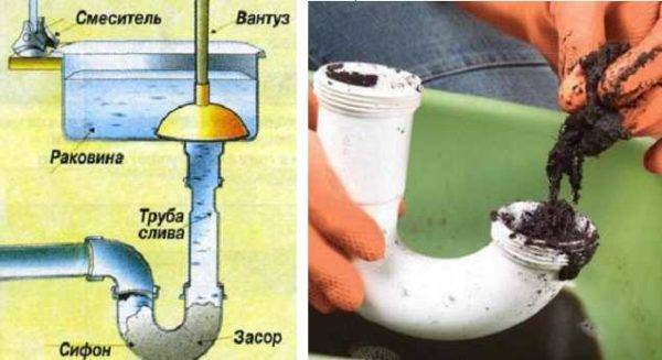 Nettoyage des canalisations d'égout : une analyse des meilleures façons de nettoyer les canalisations des blocages