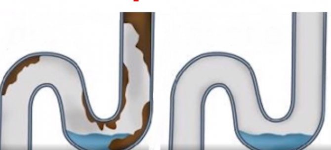 TOP 10 des meilleurs remèdes pour les canalisations bouchées : les meilleurs médicaments du marché + comment choisir le bon