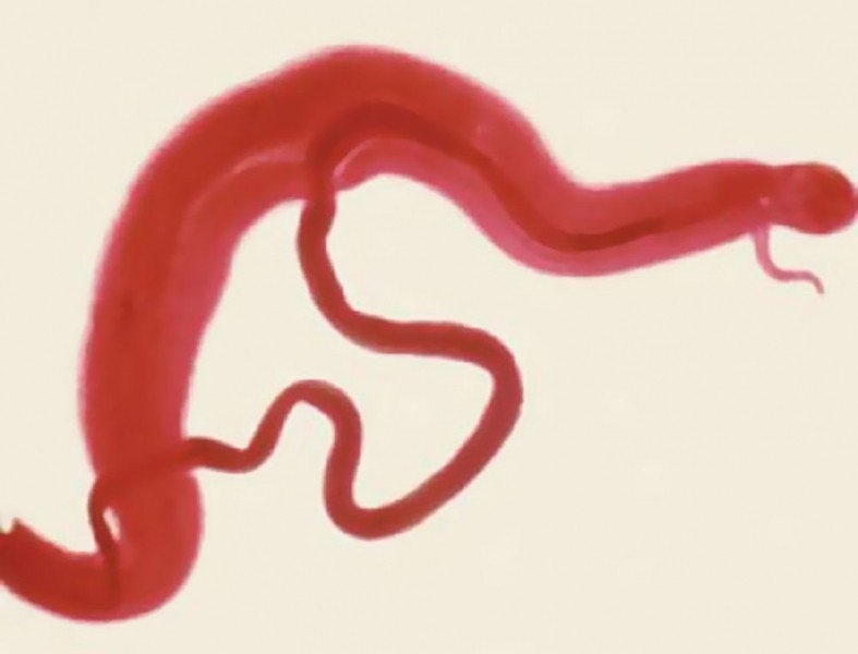 9 signes subtils que les parasites vivent en vous