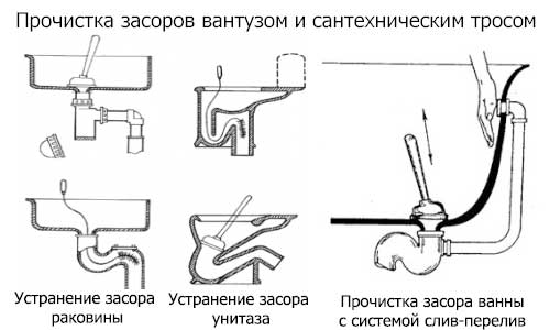 Les toilettes sont bouchées : comment les nettoyer soi-même avec des produits chimiques ménagers, du soda, du vinaigre et des appareils mécaniques