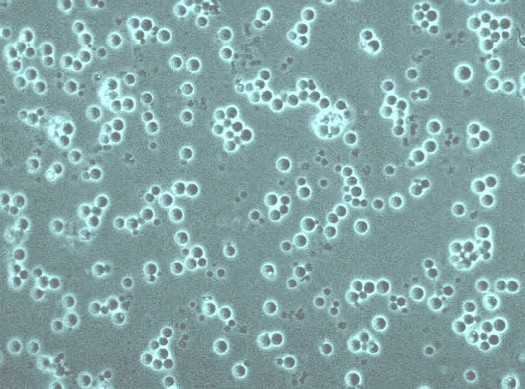 Que se passe-t-il si vous jetez de la levure dans les toilettes