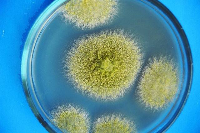 Qu'est-ce que la moisissure noire dangereuse dans la maison pour le corps humain et comment s'en débarrasser